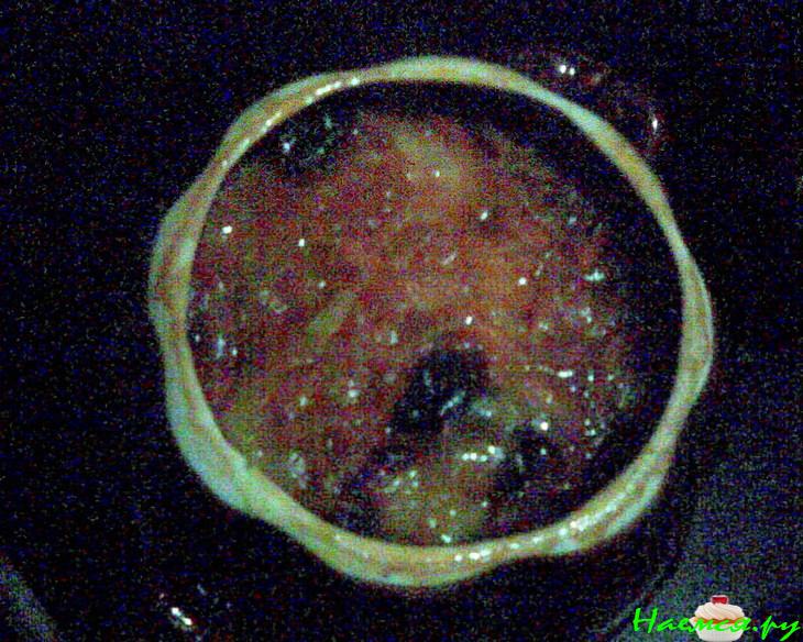 Горшочки с черносливом на любой вкус - с рыбой и куриными бедрышками